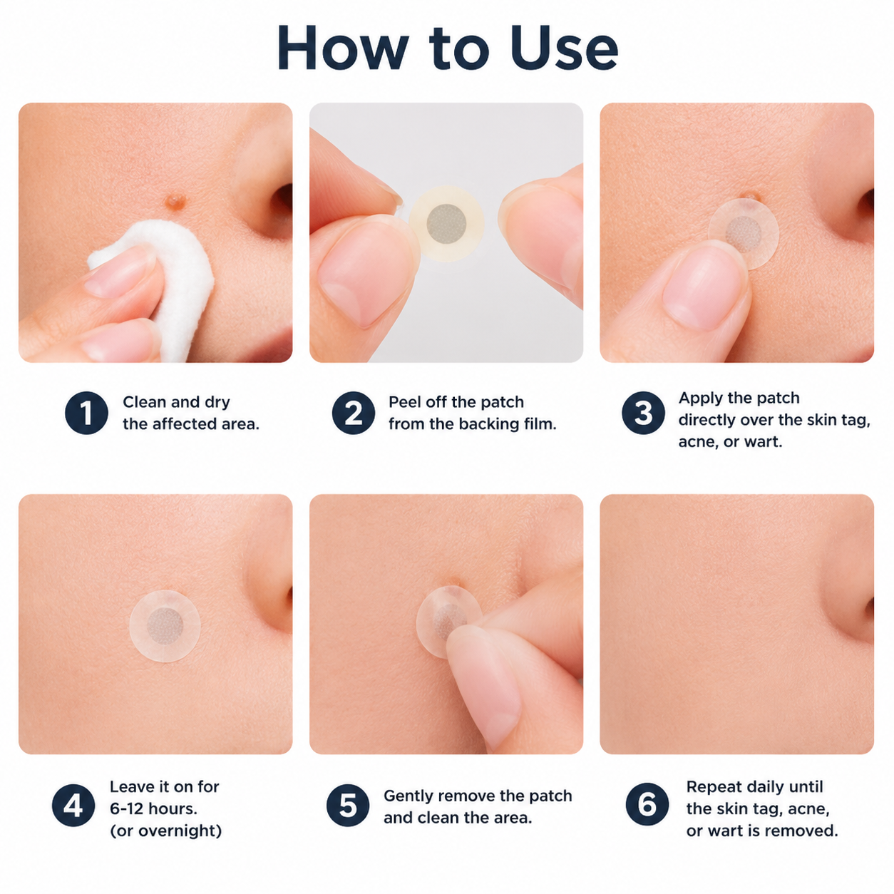 ✨KLENIMORE®2-in-1 Microneedle & Hydrocolloid Patch🍀| Removes Raised Moles, Acne, Flat Warts & Skin Tags | Helps Improve Wrinkles, Scars & Blemishes | Invisible Patches for Face & Body