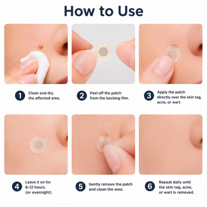 ✨KLENIMORE®2-in-1 Microneedle & Hydrocolloid Patch🍀| Removes Raised Moles, Acne, Flat Warts & Skin Tags | Helps Improve Wrinkles, Scars & Blemishes | Invisible Patches for Face & Body