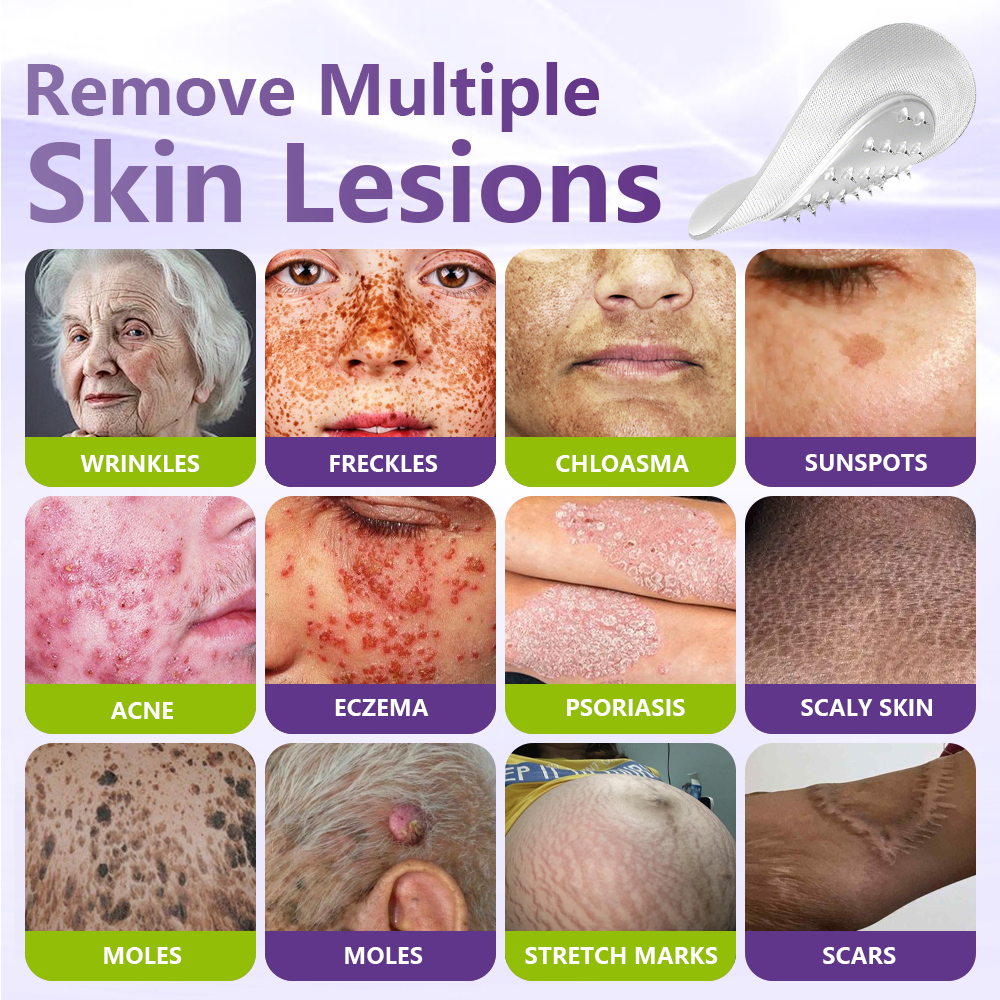KLENIMORE® Soluble Microneedle Botanical Skin Tag Removal Patch