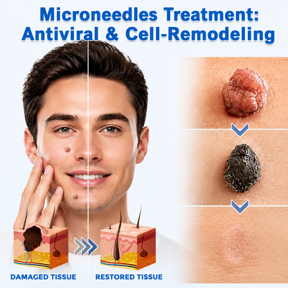 ✨KLENIMORE®2-in-1 Microneedle & Hydrocolloid Patch🍀| Removes Raised Moles, Acne, Flat Warts & Skin Tags | Helps Improve Wrinkles, Scars & Blemishes | Invisible Patches for Face & Body
