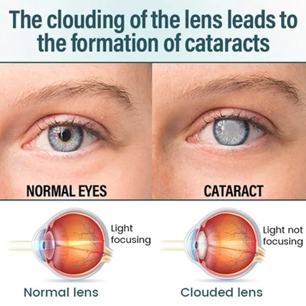 Reclaim Your Crystal-Clear Vision with KLENIMORE™ NANO Eye Drops
