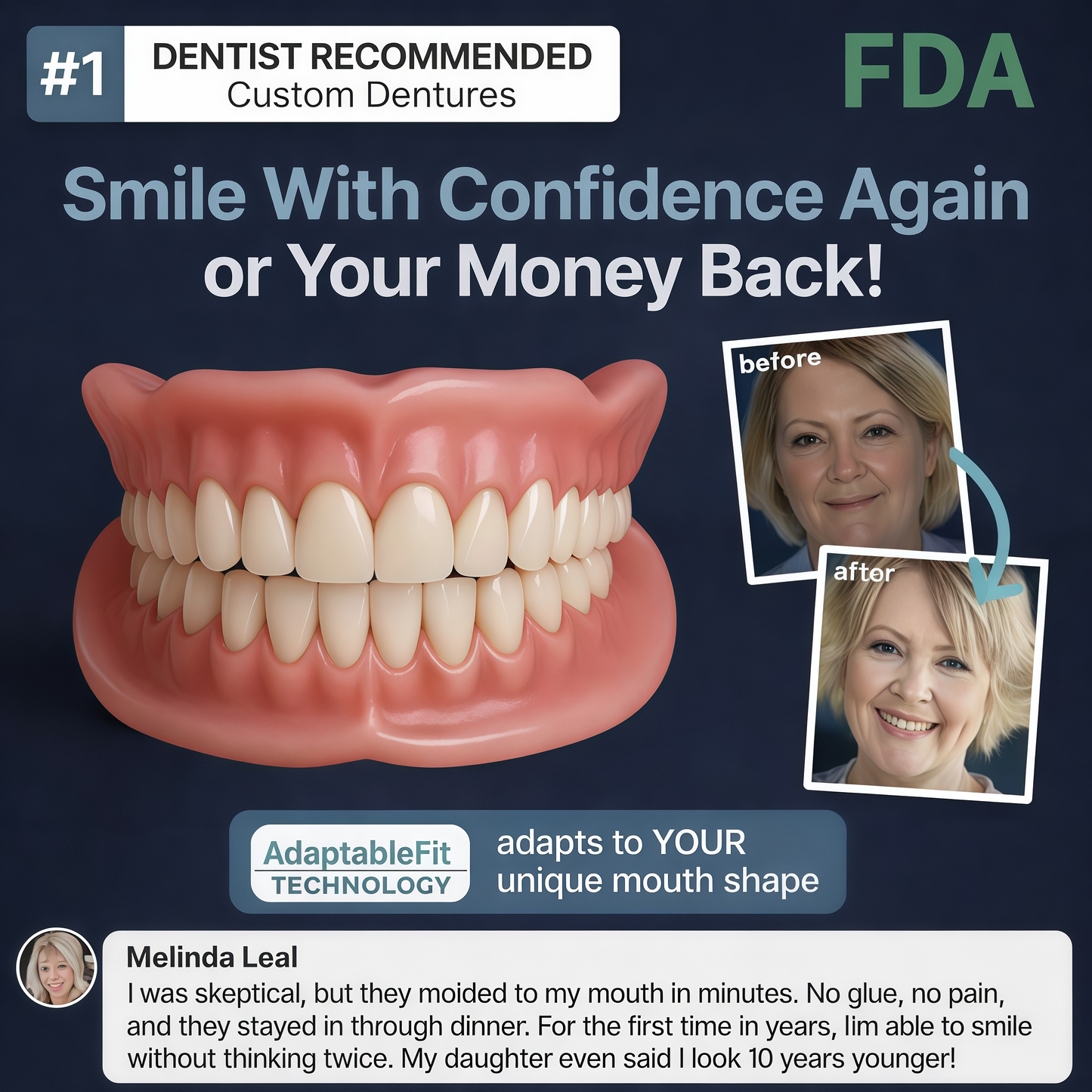 2026🏆✨LAST DAY SALE 70% OFF🔥 Newly upgraded second-generation KLENIMORE™ complete dentures