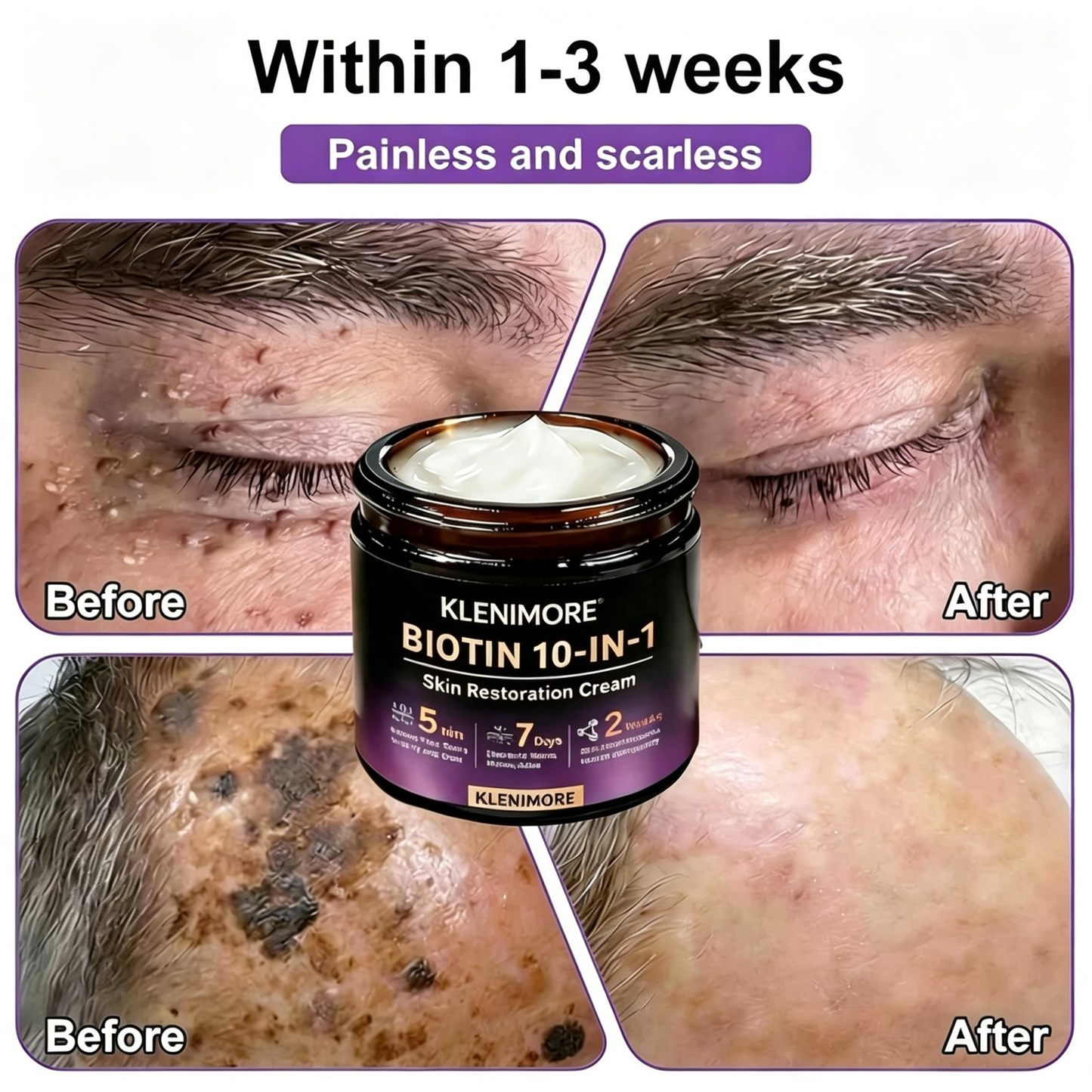 Made and Shipped from USA ✨KLENIMORE™ Biotin 10-in-1 Skin Restoration Cream 🍀