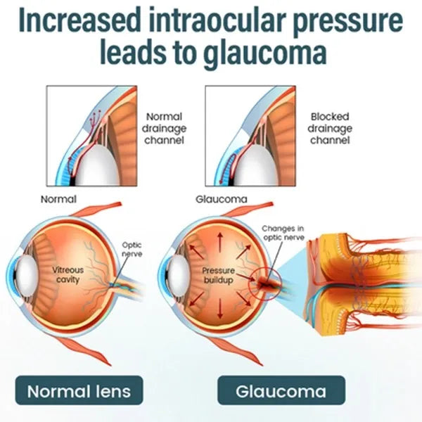 Reclaim Your Crystal-Clear Vision with KLENIMORE™ NANO Eye Drops