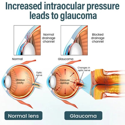 Reclaim Your Crystal-Clear Vision with KLENIMORE™ NANO Eye Drops