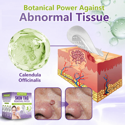 KLENIMORE® Soluble Microneedle Botanical Skin Tag Removal Patch