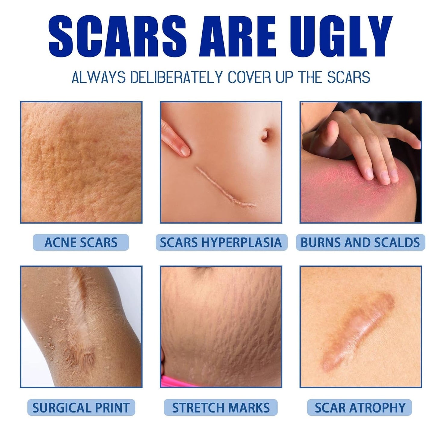 Advanced Scar Repair Cream – Smooth & Improve the Appearance of Scars