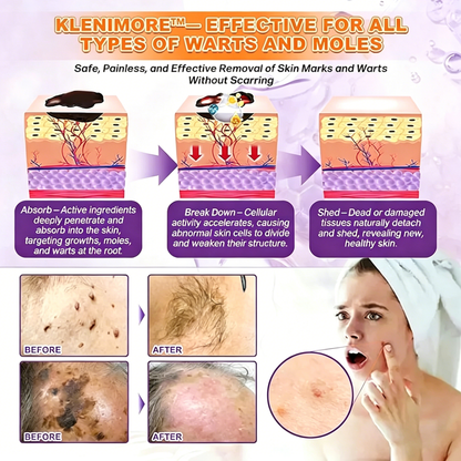 Made and Shipped from USA ✨KLENIMORE™ Biotin 10-in-1 Skin Restoration Cream 🍀