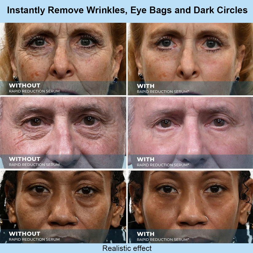KLENIMORE™ Instant Face Temporary Tightener – Instant visible results in 30 seconds