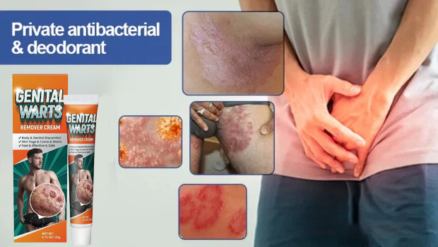Wart Wart Remover Cream for Men Genital Warts Remover Effective Quick Action Wart Removal Cream for Skin Types